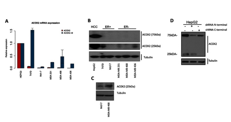 Figure 4. Expression of ACOX2 in breast cancer cell lines. ACOX2 and ACOX2-i9 mRNA levels were assessed by qRT-PCR in HepG2 cells and breast cancer cell lines (a), quantification is shown relative to HepG2 expression. Protein extracts from HepG2 and breast cancer cell lines were probed with a C-terminal antibody against ACOX2 (b). Highly sensitive chemiluminescent substrate (c) was included for illustration purposes to show even low levels of protein expression. HepG2 cells were transfected with shRNA targeting the N-terminal and C-terminal regions of ACOX2 (d).